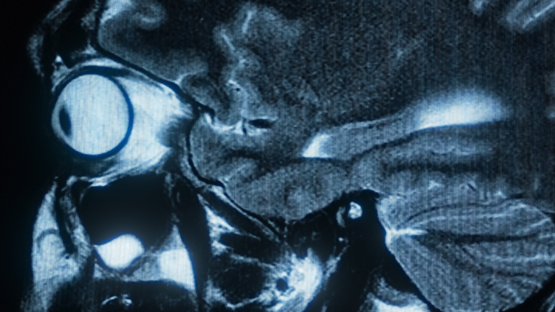 Time Matters - Kinesis Bikes - image 12