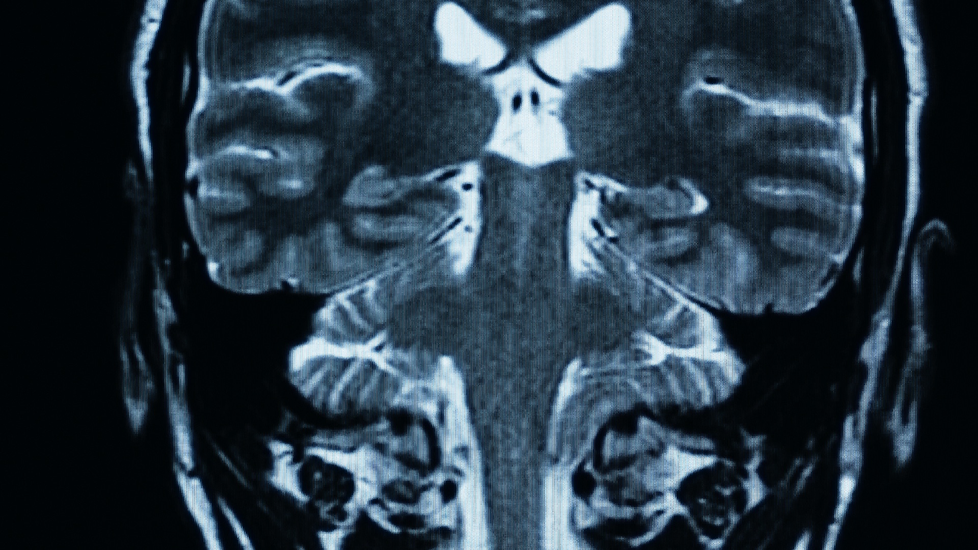 Time Matters - Kinesis Bikes - image 8